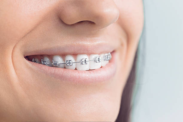 Best Dental Inlays and Onlays  in Raymond, IL